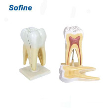 Modelo de Ensino / Estudo Odontológico, Modelo de Dente Humano, Modelos de Educação Odontológica